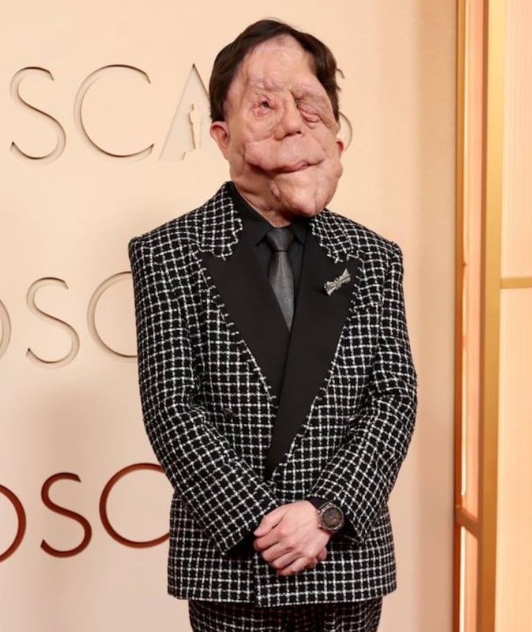 Premios Oscars 2026: quién es Adam Pearson, el actor con neurofibromatosis que genera conciencia sobre su enfermedad | Créditos: Instagram @adampearson