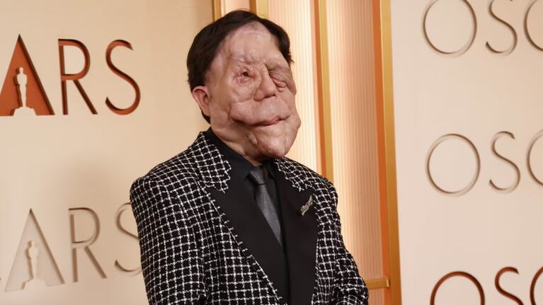 Premios Oscars 2026: quién es Adam Pearson, el actor con neurofibromatosis que genera conciencia sobre su enfermedad | Créditos: Instagram @adampearson