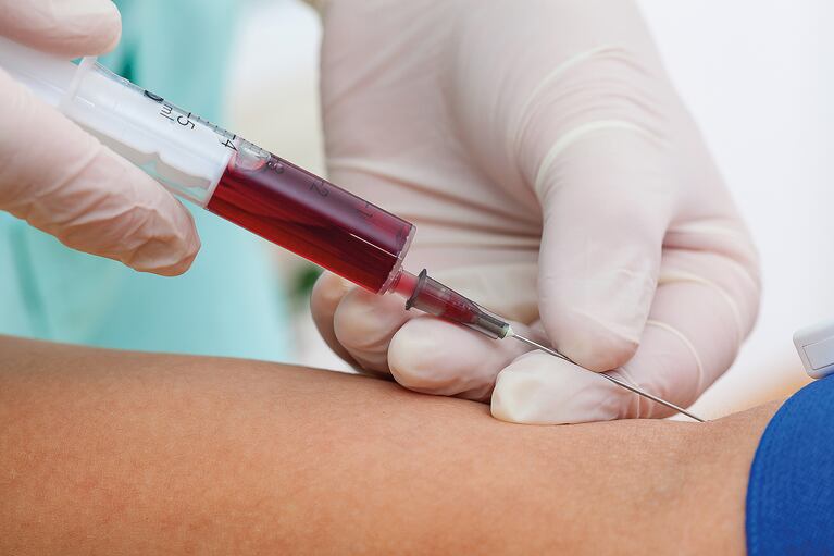Prueba de sangre evalúa lesiones cerebrales traumáticas leves