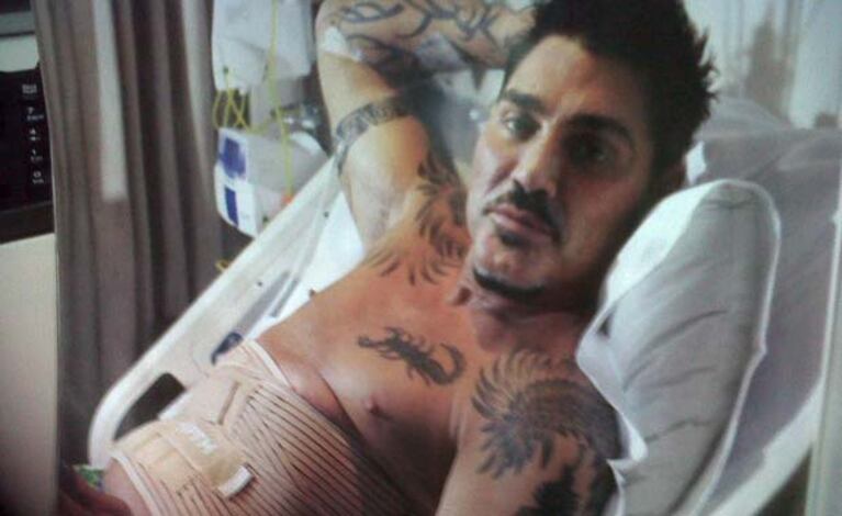 Ricardo Fort, nuevamente operadode los intestinos. (Foto: Web)