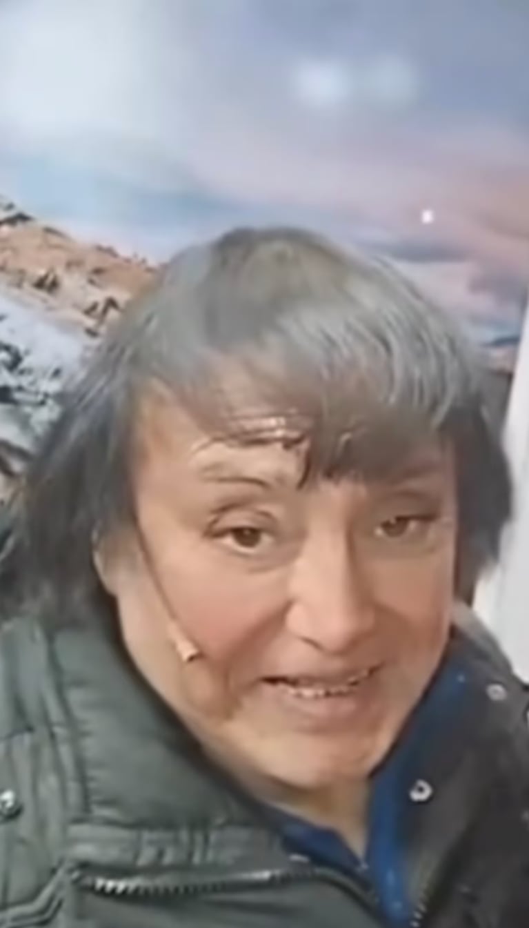 Ricky aclaró que no se hizo un retoque estético, sino que le pusieron un filtro de Instagram.