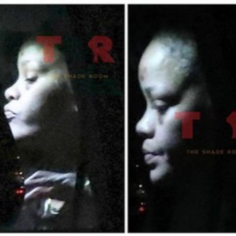 Rihanna sufrió un accidente andando en moto y se lastimó el rostro: "Se está curando rápidamente"
