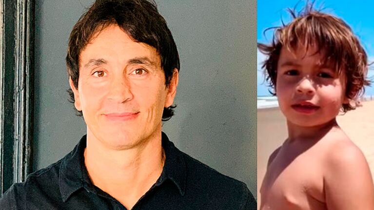 Sebastián Estevanez contó cómo reaccionó su hijo menor al verlo quemado: Ni se me acercaba porque yo era un monstruo
