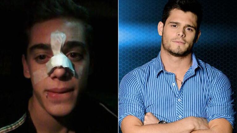 Sergio Celli, tras ser agredido por Lucas Velasco en Combate: "Me agarró del brazo y me dio un cabezazo en la nariz" (Foto: Twitter y Web)