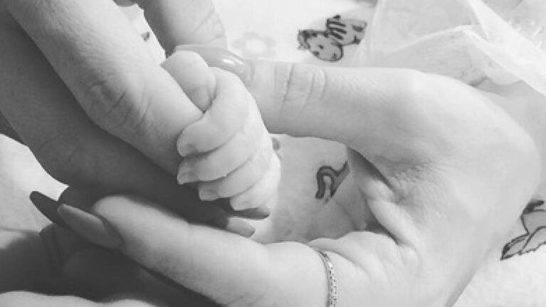 Síndrome de Patau, la rara enfermedad que sufrió la hija de Wisin