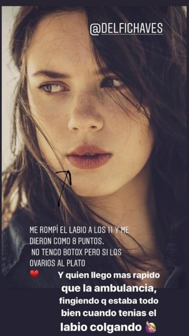 Tajante aclaración (con foto) de Delfina Chaves ante los rumores de que se operó los labios: "No tengo bótox"