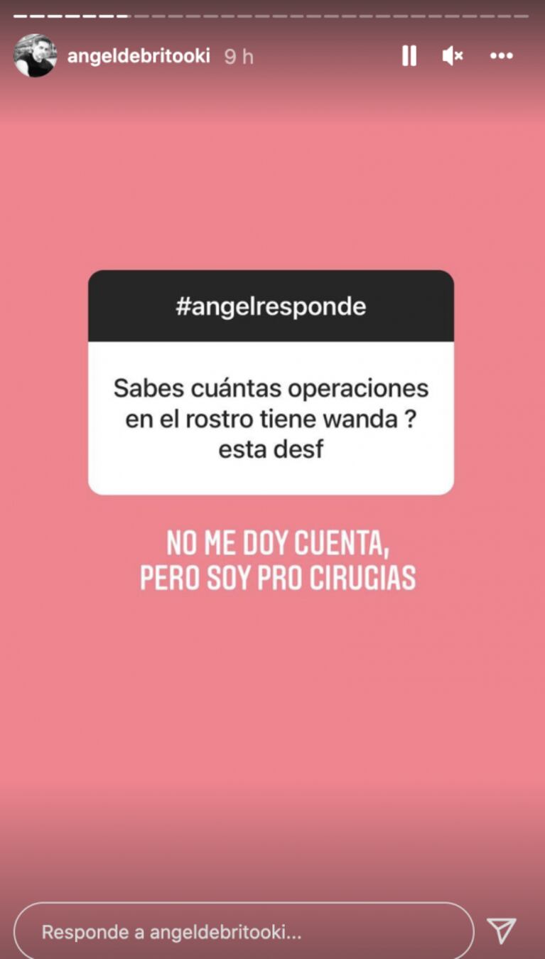 Tajante respuesta de Ángel de Brito cuando le preguntaron cuántas cirugías se hizo Wanda Nara en el rostro: "Soy pro cirugías"