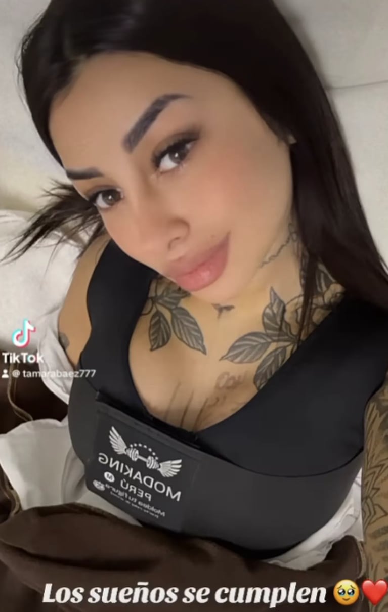 Tamara Báez después del retoque estético.