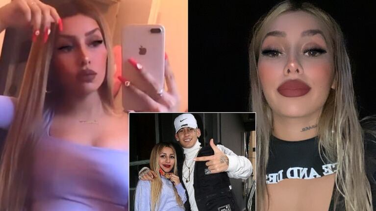 Tamara Báez, la novia de L-Gante, reveló sus retoques estéticos (Fotos: Web)