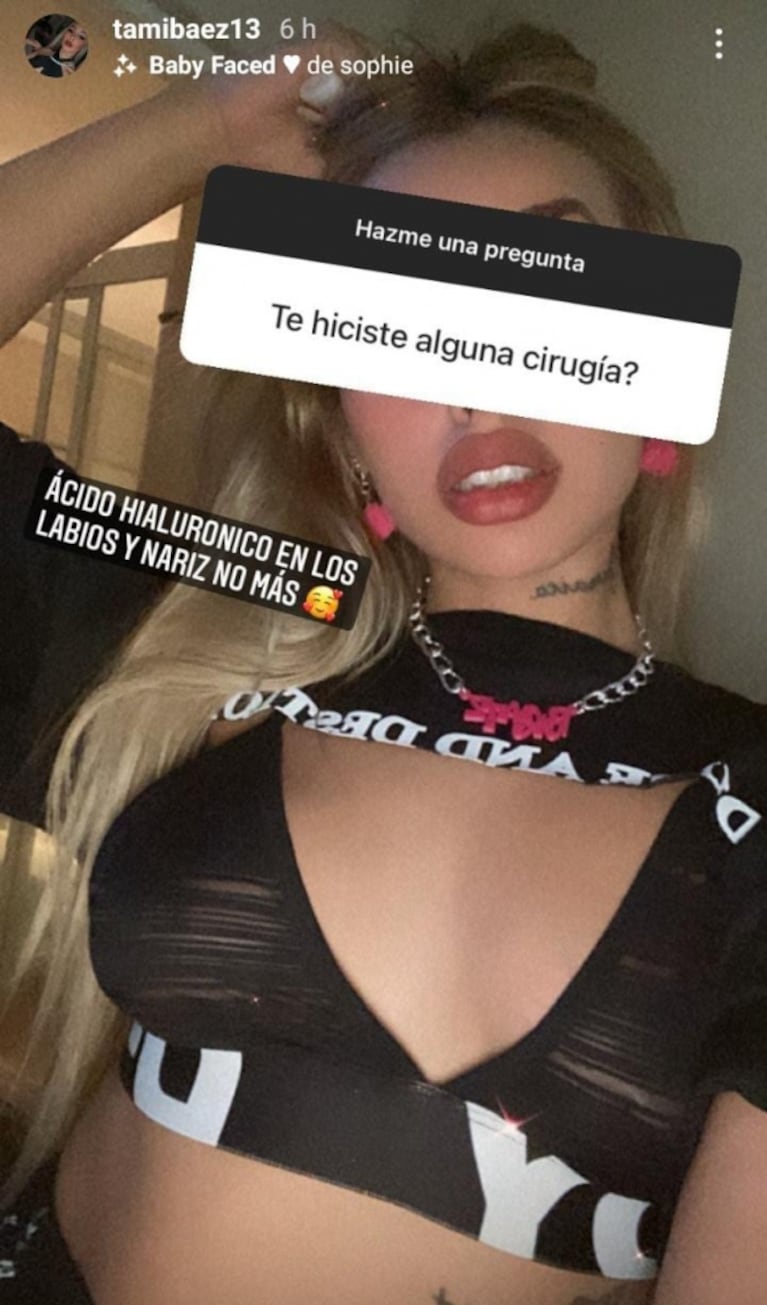 Tamara Báez, la novia de L-Gante, reveló sus retoques estéticos: "Me operé la nariz y me puse ácido hialurónico en los labios"