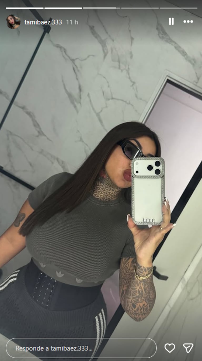 Tamara Báez mostró su nueva figura tras su liposucción | Créditos: Instagram @tamibaez.333