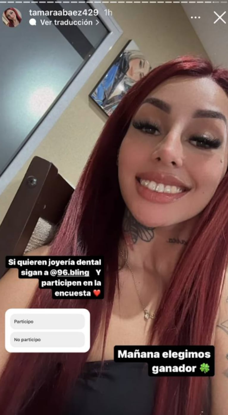 Tamara Báez se hizo otro retoque estético de lujo y lo mostró en las redes: cristales en los dientes