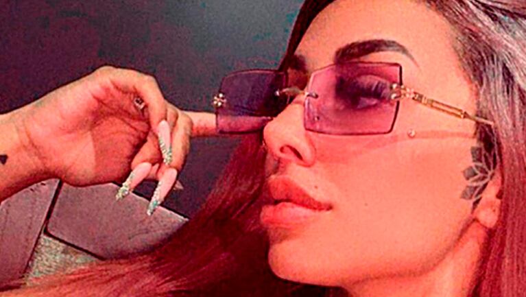 Tamara Báez se hizo un blanqueamiento dental y mostró el impactante resultado.
