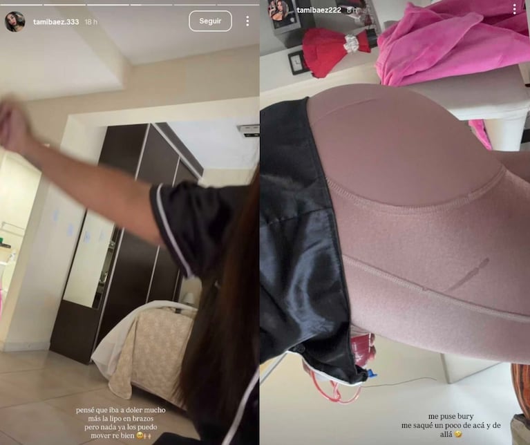 Tamara Báez se hizo una liposucción y mostró el resultado en redes. Crédito: Instagram