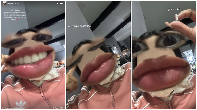 Tamara Báez se sometió a varios retoques estéticos y mostró el doloroso resultado de su nuevo tatuaje en el cuello. Crédito: Instagram/@tamibaez222