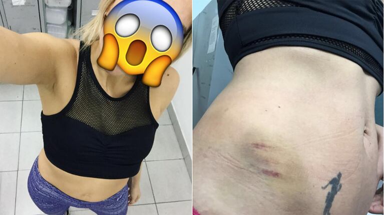 Tamara Pettinato mostró un impresionante golpe que se hizo en un ensayo para la salsa de tres (Foto: Instagram)