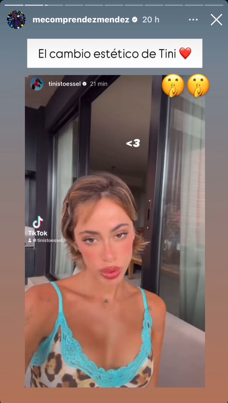 Tini Stoessel se habría hecho una cirugía estética (Foto: captura de Instagram de @mecomprendezmendez)