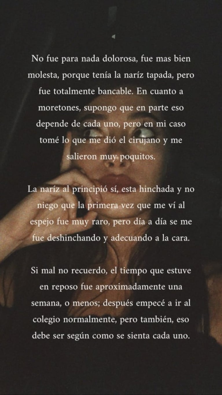 Tiziana Sabatini habló de su cirugía estética: "A veces piensan que me da vergüenza decirlo"