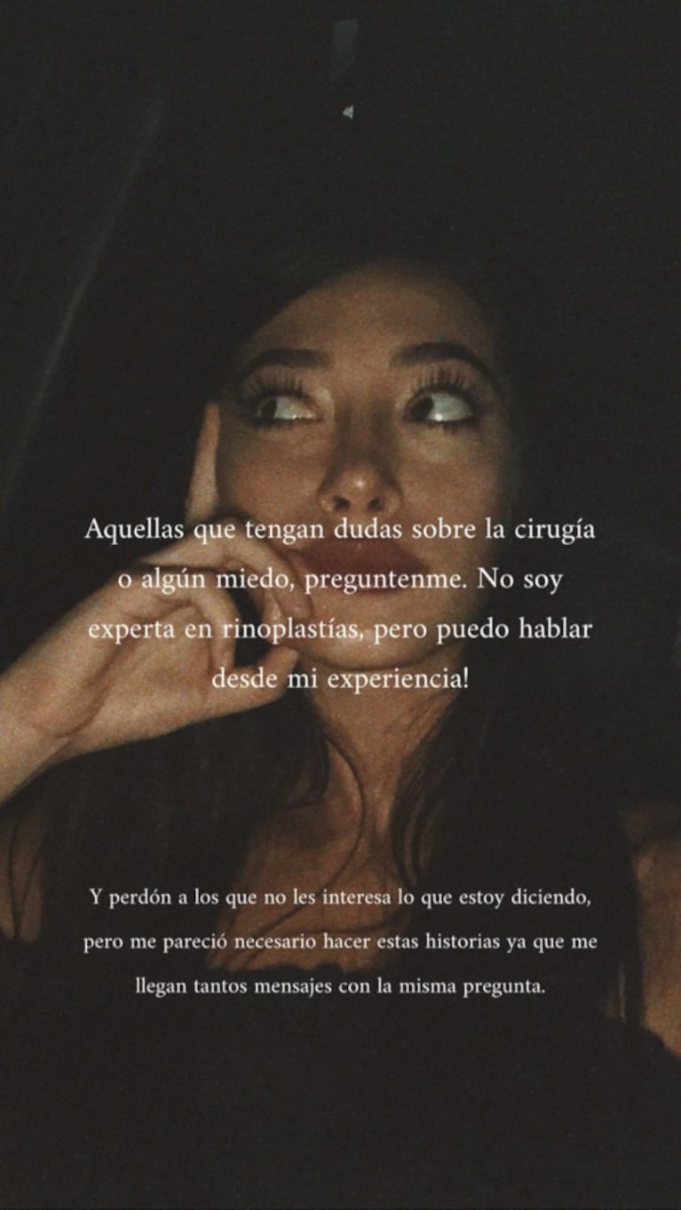 Tiziana Sabatini habló de su cirugía estética: "A veces piensan que me da vergüenza decirlo"