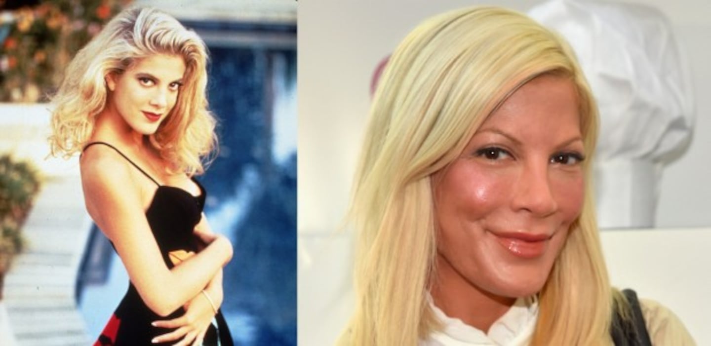 Tori Spelling se considera "adicta al botox"