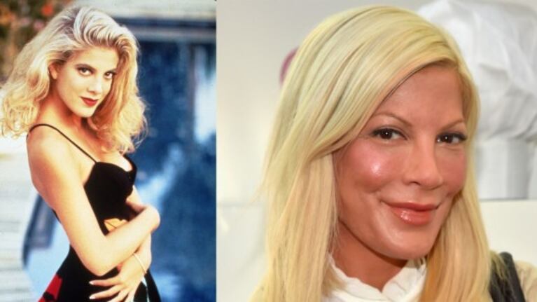Tori Spelling se considera "adicta al botox"