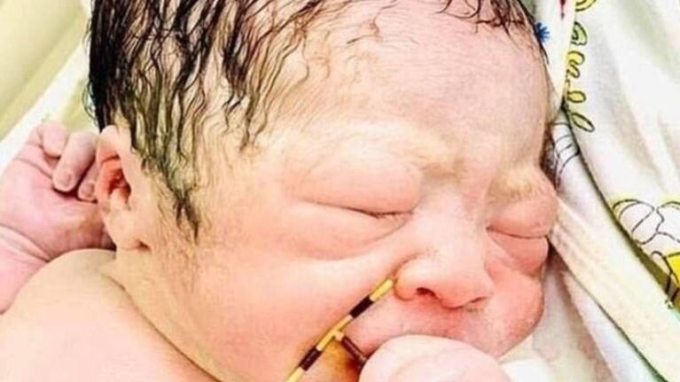 Un bebé nació en Vietnam con el DIU de su mamá en la mano