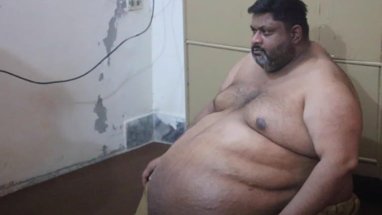 Un hombre que pesa 280 kilos está desesperado por una operación que le salve la vida