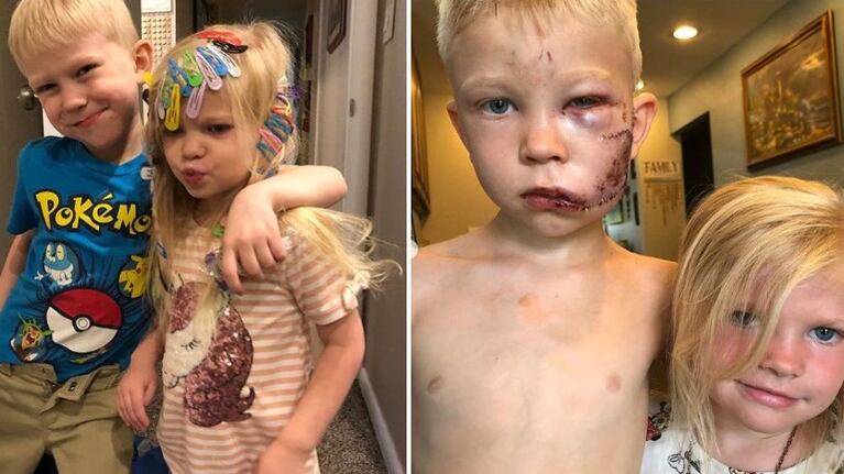 Un niño salvó a su hermanita de ser mordida por un perro