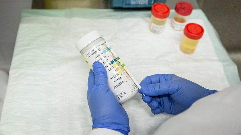 Un simple test de orina puede detectar el cáncer de útero, según estudio británico. Foto: Flickr