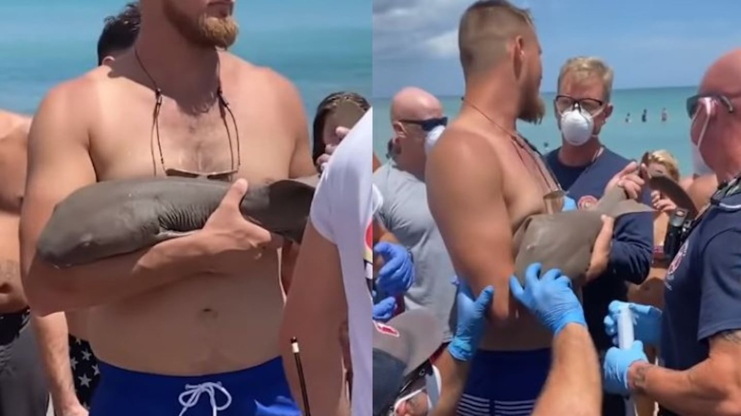 Un tiburón gata muerde el brazo a un hombre y se niega a soltarlo hasta que llegan los paramédicos