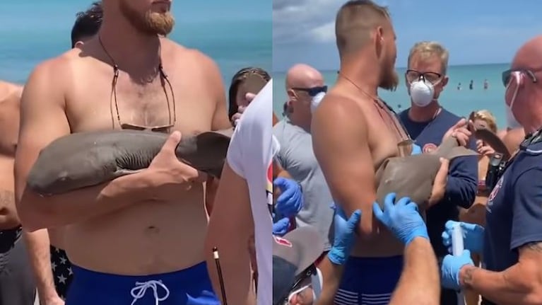 Un tiburón gata muerde el brazo a un hombre y se niega a soltarlo hasta que llegan los paramédicos
