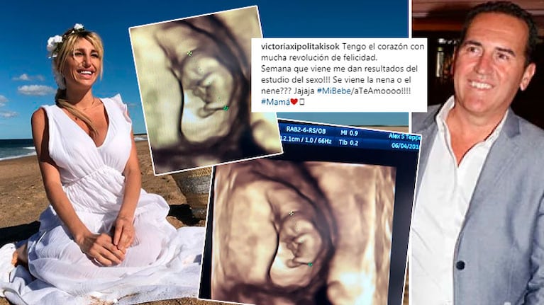 Vicky Xipolitakis compartió la ecografía de su bebé
