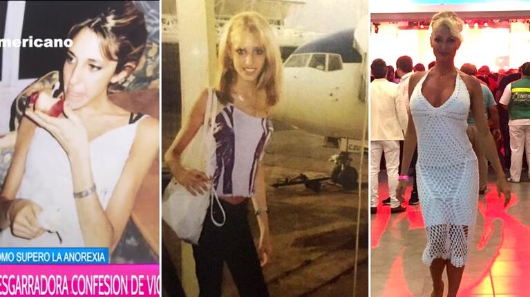 Vicky Xipolitakis en su periodo de anorexia nerviosa y ahora.  (Foto: Web)