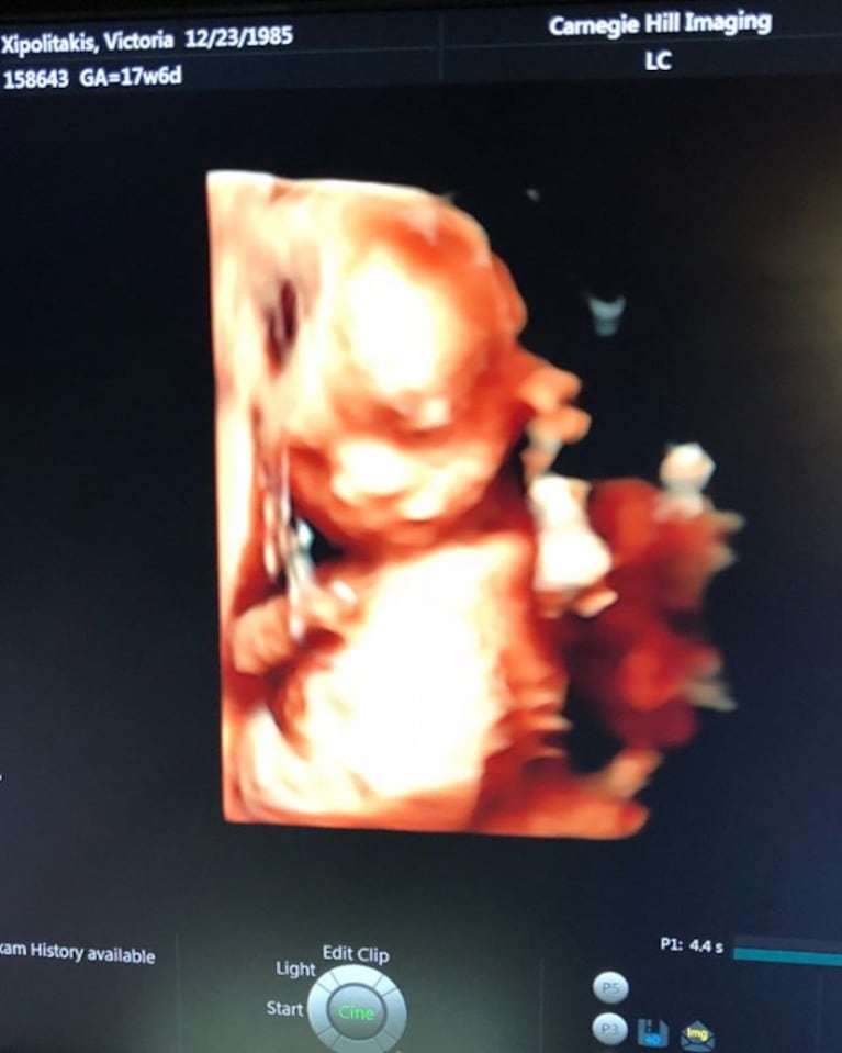 Vicky Xipolitakis mostró la ecografía 4D con la carita de su bebé: "Les presento al milagro de cuatro meses" 