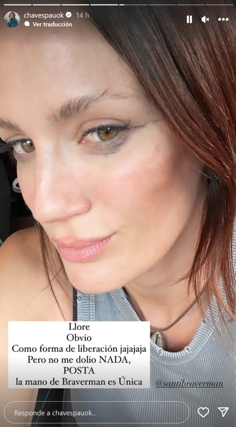 Video: Paula Chaves lloró en el dentista por una tremenda intervención odontológica