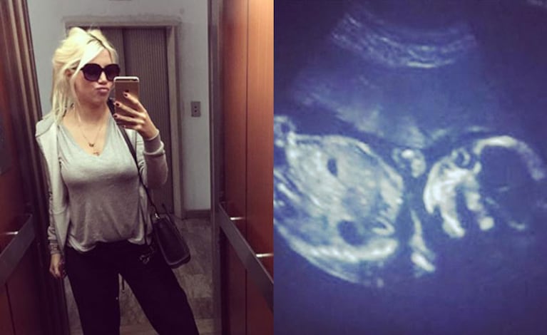 Wanda Nara compartió en Twitter, la eco de su hija. (Foto: web)