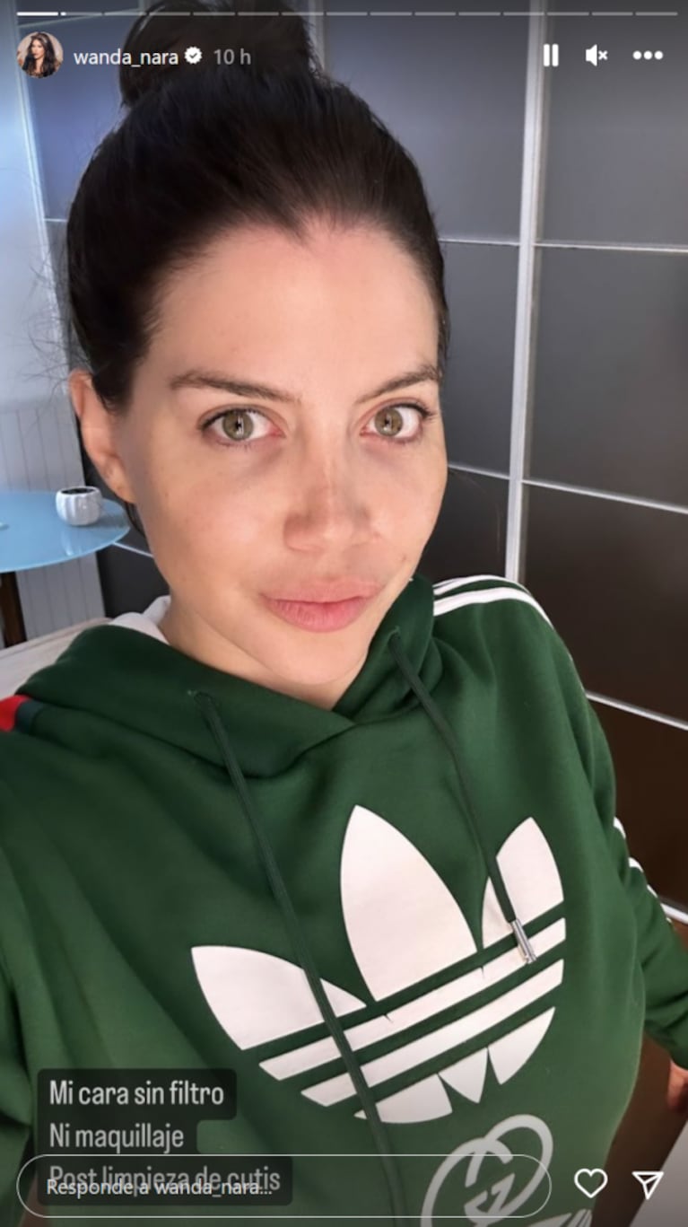 Wanda Nara se mostró a cara lavada, sin filtros ni maquillajes: "Post limpieza de cutis"