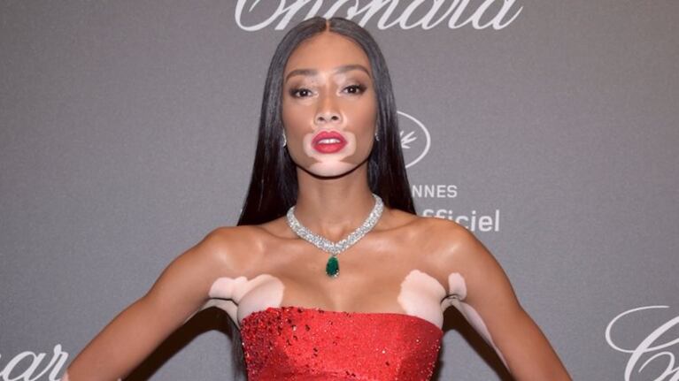 Winnie Harlow: “A veces es complicado lidiar con la fama”