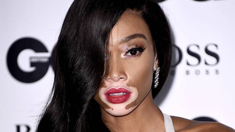 Winnie Harlow busca acabar con los estereotipos en el mundo de la moda