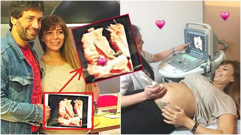 Ximena Capristo y Gustavo Conti presentaron a su hijo en camino a través de una ecografía 5D (Fotos: Instagram)