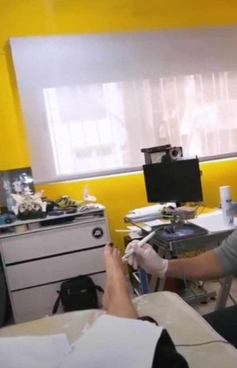 Yanina Latorre contó que tiene Neuroma de Morton: cómo lo está tratando