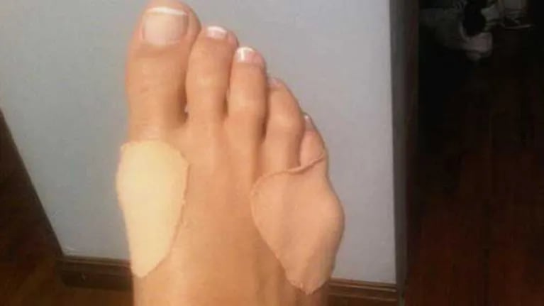 El pie herido de Amalia Granata