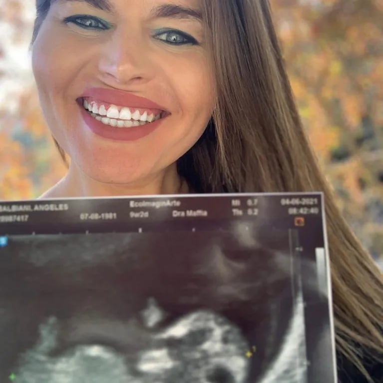 La emoción de Angie Balbiani al anunciar su embarazo: "Gracias a la vida por cumplir mis sueños"
