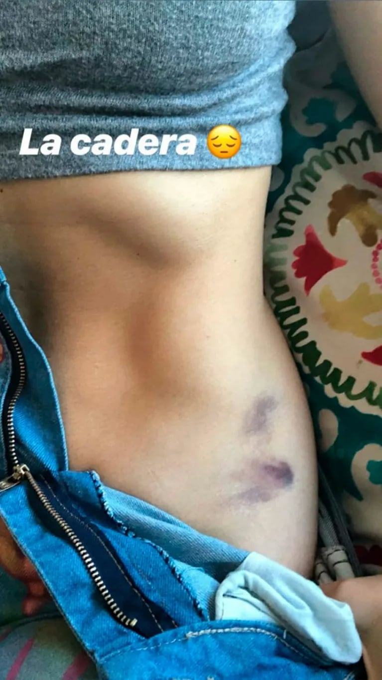 El video del tremendo golpe de Jimena Barón ensayando para el aquadance: "Mi lesión"