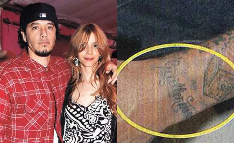 Tras saber del romance de Guillermina y Tinelli, Ortega se borró el tattoo con su nombre (Foto: Caras). 